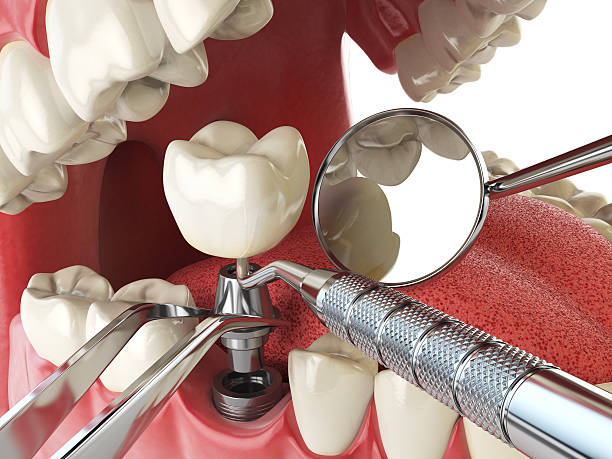 Best Emergency Root Canal Treatment in Woodsi East, DE